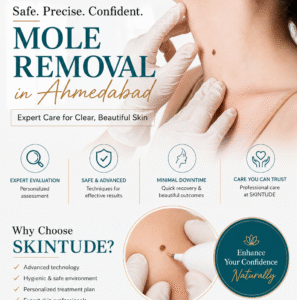 Mole Removal in Ahmedabad