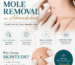 Mole Removal in Ahmedabad