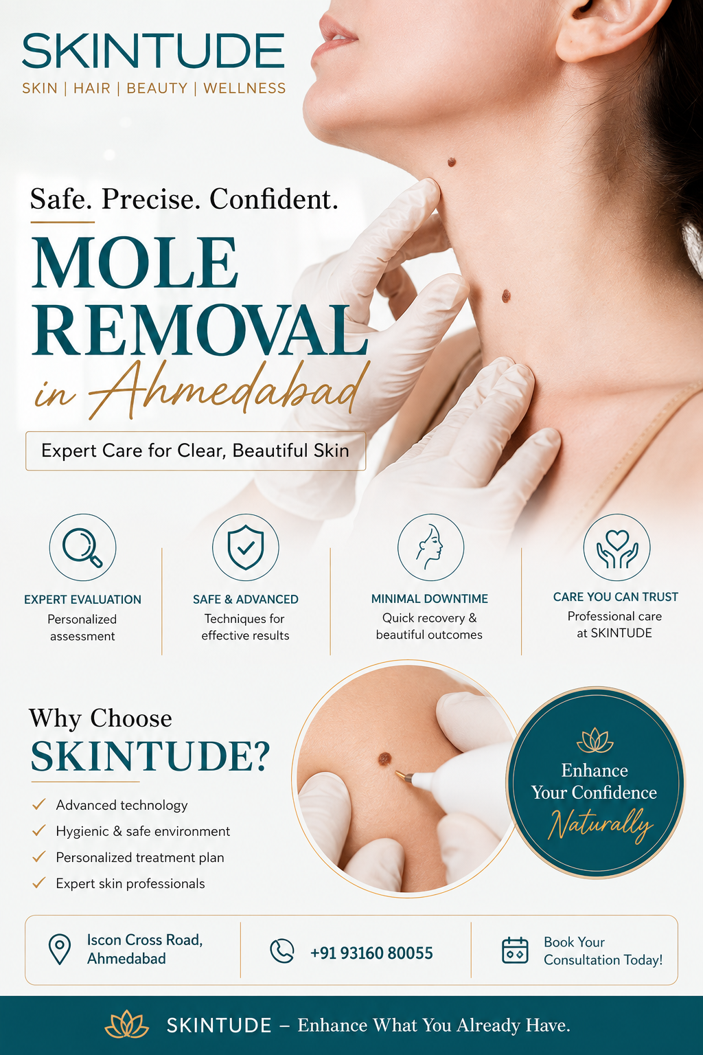 Mole Removal in Ahmedabad